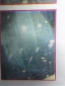 PP spot or Bleach spot
